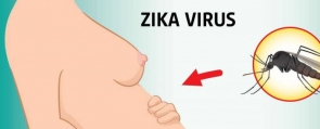 ZIKA